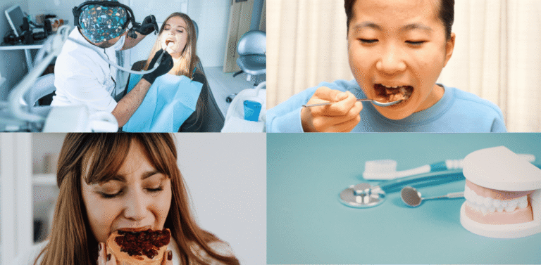 What to Eat After Wisdom Teeth Removal
